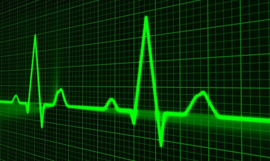 Notice – Delays Possible If There Are Server Problems